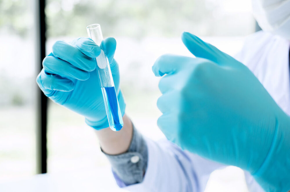 Chemical-Resistant Gloves - Image 5